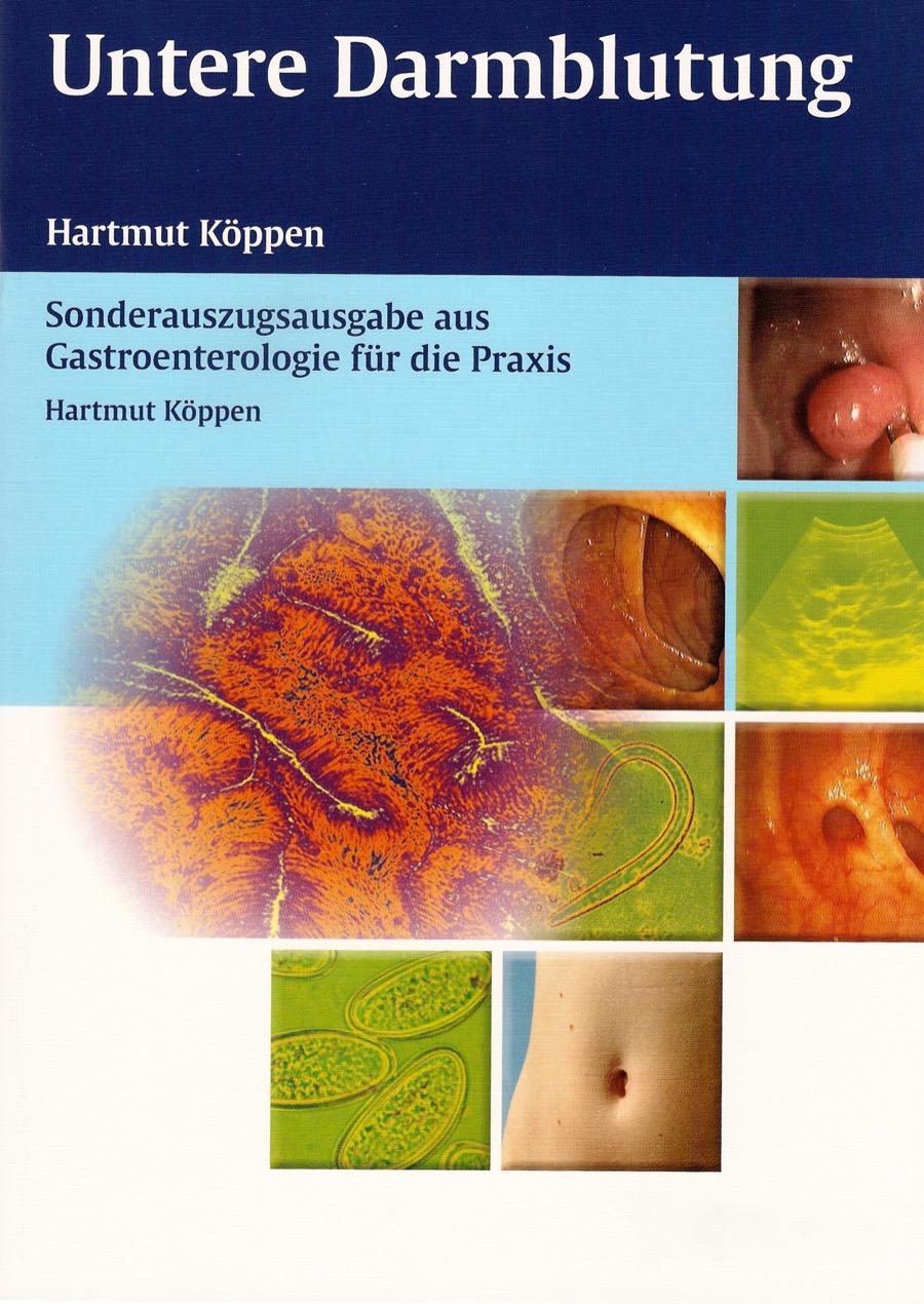 Cover: Untere Darmblutung von Hartmut Köppen